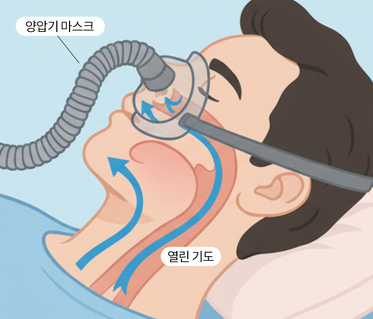 치료